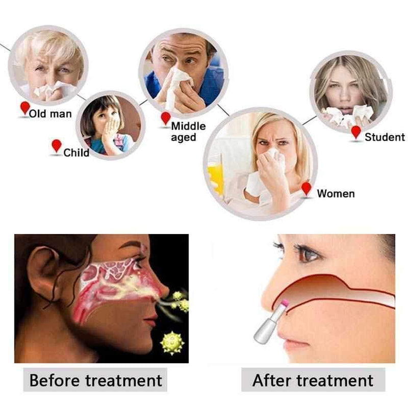 Rinite Therapy® - Red Light Therapy for Rhinitis, Sinusitis & Nasal Relief